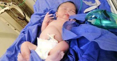نجاح أول عملية ولادة قيصرية لمريضة كورونا بمستشفى الإسماعيلية للعزل.. صور