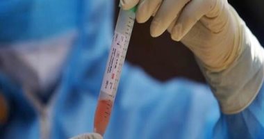 باحثون: فحص دم لمرضى كورونا يحدد احتمال تعرضهم لمضاعفات فى المستقبل