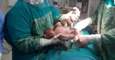 صور.. أطباء مستشفى الأقصر للعزل الصحى يجرون ولادة قيصرية لمصابة بكورونا