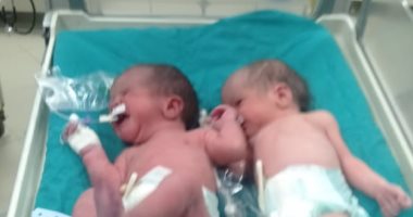 مستشفى المنيرة يجرى عملية ولادة قيصرية لحامل بتوأم مصابة بكورونا