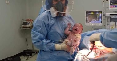 ولادة قيصرية لمريضة بكورونا بمستشفى الأحرار للعزل.. صور