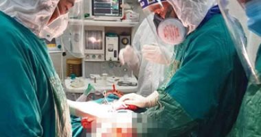 مستشفى الأقصر العام تجرى عملية "قرحة منفجرة" لسيدة مصابة بكورونا.. صور