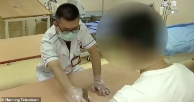 طفل صينى يصاب بالشلل بذراعه اليسرى بعد قضاء 22 ساعة يوميا أمام ألعاب الفيديو