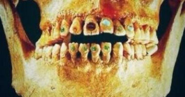 دراسة الحمض النووى للأسنان تكشف: الإنسان عانى من الطاعون قبل 5 آلاف سنة