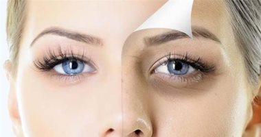 الشيخوخة وعوامل الوراثة.. أسباب مختلفة لظهور الأوردة البارزة تحت العينين