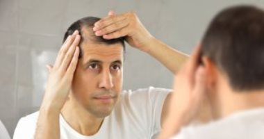 4 أنواع من الأضرار النفسية لتساقط الشعر عند الرجال.. اعرف طرق العلاج