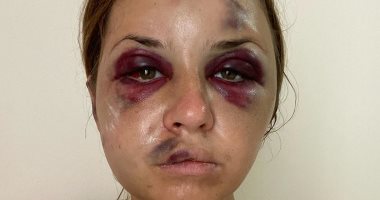 مذيعة أوكرانية تروى قصة اغتصابها وضربها فى قطار وسط صراخ ابنها.. فيديو وصور