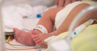 أسباب شق سقف الحلق عند الرضع والعمر المناسب للجراحة 