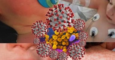"CDC" يحذر من متلازمة التهاب الأجهزة المتعددة للأطفال المرتبطة بكورونا