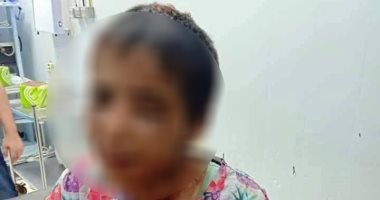 محافظ كفر الشيخ يتابع علاج الطفلة أمنية ضحية التعذيب طبياً وتأهيلها نفسياً