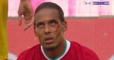 إصابة قوية في وجه فان دايك خلال مباراة ليفربول ضد سالزبورج