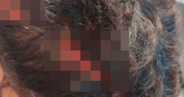 الاعتداء على طالب جامعى بأسلحة بيضاء وسرقة متعلقاته بالمحلة.. صور وفيديو