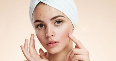 Ways to treat acne safely during pregnancy .. including sulfur lotion for the face