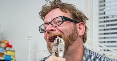 عامل بريطانى يخلع أسنانه بـ"الزرادية" لعدم قدرته على الذهاب لطبيب بسبب كورونا