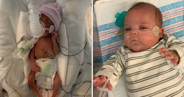 طفل مولود حديثًا يزن رطلاً ويخرج من المستشفى بعد 133 يوما بأمريكا..صور