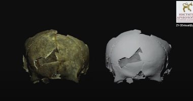 اكتشاف جمجمة لشاب تعود للعصر الحجرى بالقرم تعرضت لجراحة فاشلة