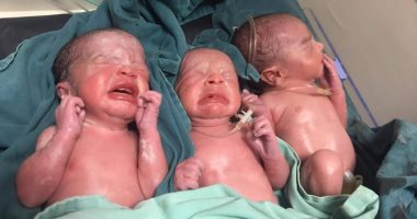ولادة 3 توائم بمستشفى الأقصر العام