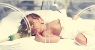 أسباب الالتهاب الرئوي الخلقي عند الأطفال حديثي الولادة