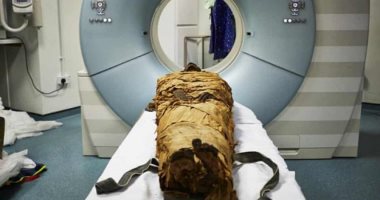 اكتشاف جسم غريب داخل بطن مومياء مصرية بمتحف بلوك.. هل كان يغطى جرحا؟