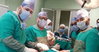 مستشفى التأمين الصحى ببنى سويف تنجح فى تعديل إعوجاج مفصل طفلة