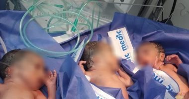 عملية ولادة ناجحة لـ3 توائم بمستشفى إسنا جنوب الأقصر.. صور