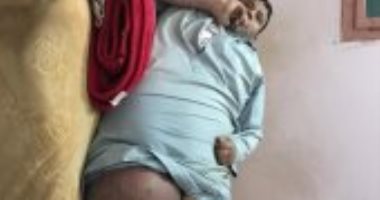 استجابة لـ"اليوم السابع".. وزارة الصحة توجه بعلاج مريض سنباط بمستشفى معهد ناصر‎
