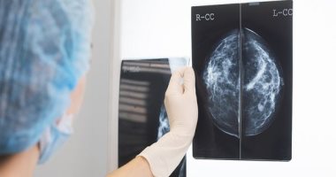 إرشادات التصوير الإشعاعى للثدى للناجيات من السرطان