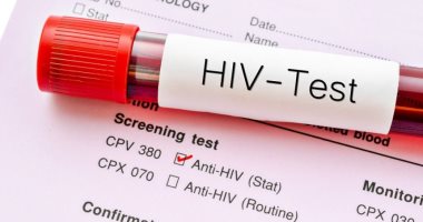 الصحة توضح الفرق بين الإصابة بالإيدز وفيرس نقص المناعة البشرى 