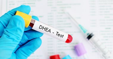 تعرف على تحليل DHEA-S الذى يكشف نسبة هرمون الأندروجين فى الدم