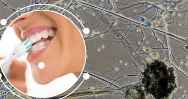 7 نصائح لتعزيز صحة الفم والوقاية من الفطريات السوداء