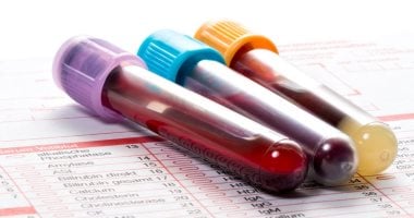 Blood tests reveal a rare type of cancer.. Know it