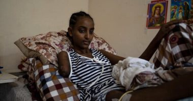أطباء بلا حدود: أعداد صادمة من وفيات الأطفال بسبب سوء التغذية فى شرق إثيوبيا