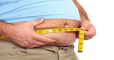 A study warns: Obesity and a fatty diet may cause hair loss