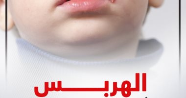 الهربس.. أعراض الإصابة بالفيروس وخطوات تجنب العدوى (إنفوجراف)