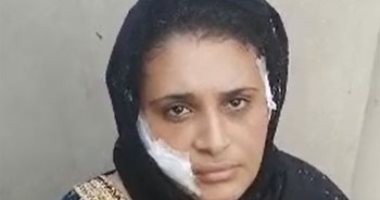 165 غرزة فى وجه سيدة بالدقهلية.. عامل يعتدى على مطلقته بسلاح أبيض.. الضحية: "أنا ما طلبتش حاجة غير نفقة الأولاد.. والمحكمة أيدت طلبى لكنه تهرّب من الدفع 6 سنوات".. وتؤكد: "كان عايز يدبحنى والأهالى أنقذونى"