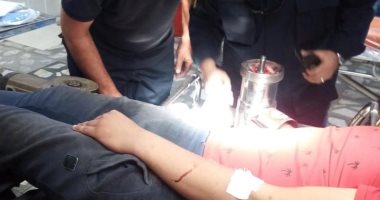 «طوارئ طنطا الجامعى» تنقذ يد شاب من البتر بعد انزلاق كفه فى المفرمة