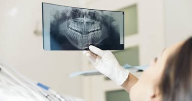 ما هي الأشعة البانورامية وما استخداماتها في كشف مشاكل الأسنان؟