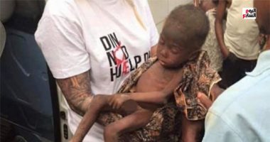 الطفل المسحور.. نهاية المأساة وبداية الحياة لـ"هوبي" النيجيرى "فيديو"