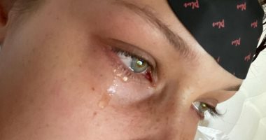 دموع وكانيولا..عارضة الأزياء بيلا حديد: وسائل التواصل الاجتماعي ليست حقيقية