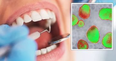 التهاب الأمعاء قد يؤثر على صحة أسنانك.. اعرف طرق الوقاية