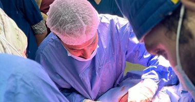 فريق طبى بمستشفى سوهاج الجامعى ينجح فى استخراج لوح خشبى من جسد شاب