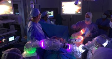 مستشفى عين شمس يجرى 25 جراحة ناجحة باستخدام الروبوت.. صور