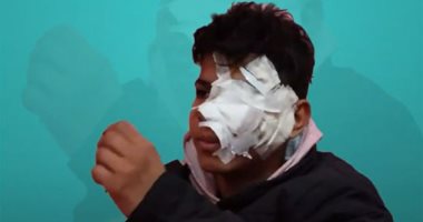 رفض يغششه فأصابه بـ44 غرزة.. طالب يضرب زميله بـ"رقبة إزازة" بالقليوبية.. فيديو