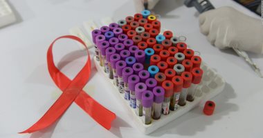  10 حقائق عن فيروس نقص المناعة البشرية "الإيدز" 