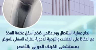 أطباء مستشفى الكرنك بالأقصر ينجحون فى استئصال ورم عظمى ضخم لمريض