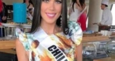 ملكة جمال تشيلية تنشر صورها بعد إجراء عملية تجميل بسبب تعرض وجهها للحرق