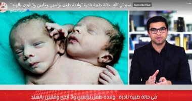 ولادة طفل برأسين و3 أيدى وقلبين في حالة نادرة (فيديو)