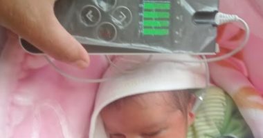 توقيع الكشف الطبى على 11 ألف طفل حديث الولادة بمراكز المنيا