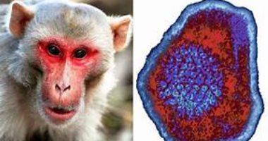 هل مضادات الفيروسات تعالج الإصابة بجدري القرود؟ دراسة تجيب