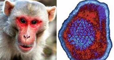 "PCR" للكشف وتشخيص جدرى القرود .. التطعيم بعد 4 أيام من الإصابة بالفيروس 